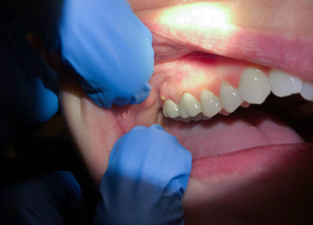 Best Urgent Dental Care for Toothache in Rossmoor, NJ